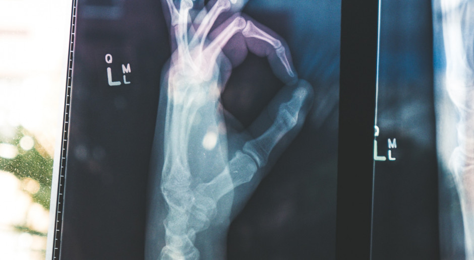 Opracowano implanty, które przyspieszą regenerację kości i leczenie, m.in. chorych na osteoporozę