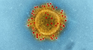 Wirusolog: Liczby zachorowań, jakie były podawane podczas piątej fali COVID-19 mogły być pięciokrotnie niedoszacowane